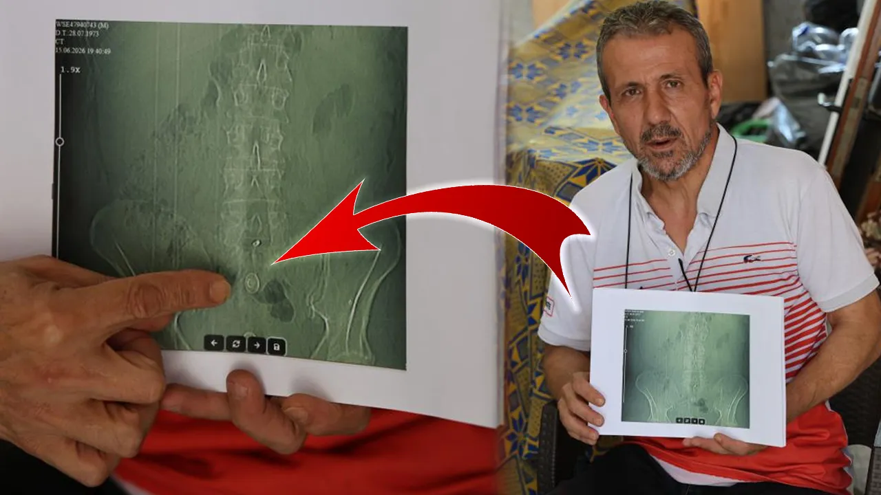 Belinde kalan parçayı çıkarmaya hiçbir doktor yanaşmıyor